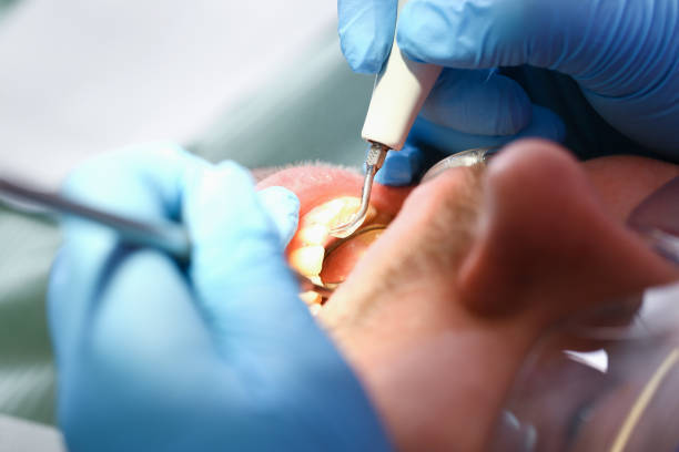 Best Emergency Dental Services for Seniors in Crafton, PA