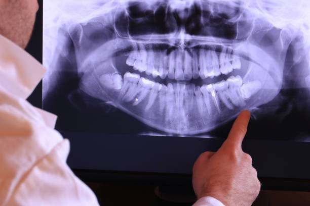 Best Emergency Dentist for Knocked-Out Tooth in Crafton, PA